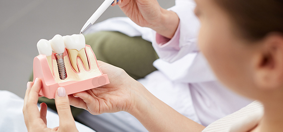 Keith Nelson Dentists Ponsonby Auckland Dental Implants