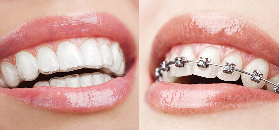 Keith Nelson Family Dentist Orthodontics