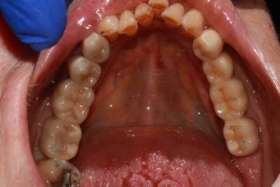 Keith Nelson Dentists Ponsonby smile gallery